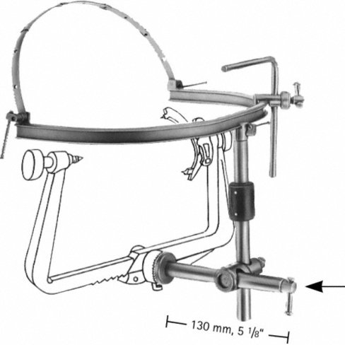 Elément de fixation