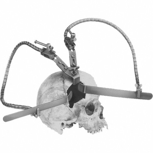 Ecarteur autostatique Leyla Yasargil