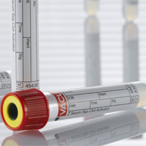 Tube VACUETTE z 3,5 ml sérum activ coag avec gel 13x75 mm bouch vissant rouge bague jaune étiq transp x 24 racks 50