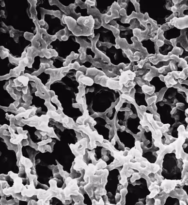 Membrane mf-millipore mixed cellulose esters hydrophile 5,0 µm 25 mm blanc plain x 100