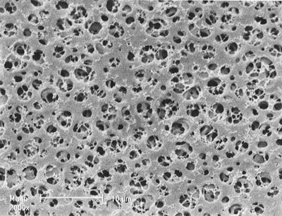 Membrane acétate 0,45 µm 47 mm stérile x 100