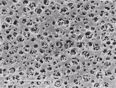 Membrane acétate 0,2 µm 47 mm hydrophobe stérile quadrille noir x 100