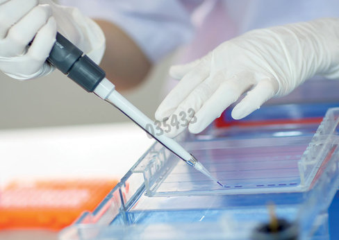 Gel agarose 1% tae avec bet 6 lignes de depots de 16+2 puits 5 pcs