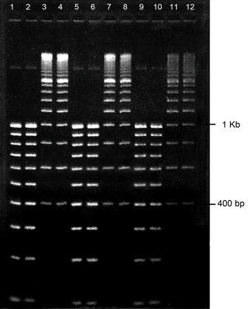 Gel agarose 4% tbe avec bet 12 puits 10 pcs