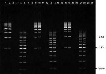 Gel agarose 1% tbe avec bet 24+1 puits 5 pcs