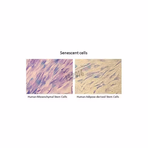 Senescence kit