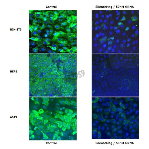 Réactif de transfection silencmag kit de démarrage sirna 1 Kit