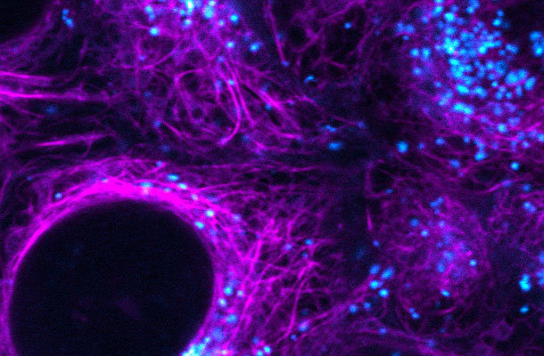 Alpha-bungarotoxin, cf555 100 µg