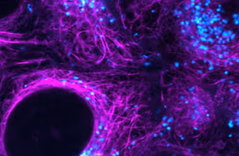 Alpha-bungarotoxin, cf543 100 µg