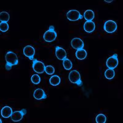 Calcofluor white stain, 5mm in water 20 ml