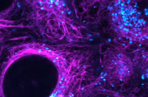 Nucview 488 and reddot 2 apoptosis and necrosis kit 100 réactions