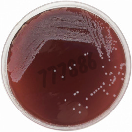 Tryptose blood agar base 500 g