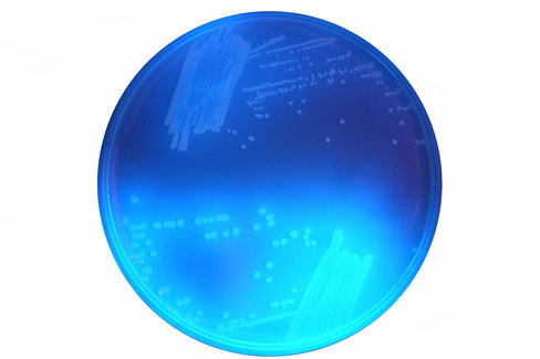 Chromagar clostridium difficile - 2x10