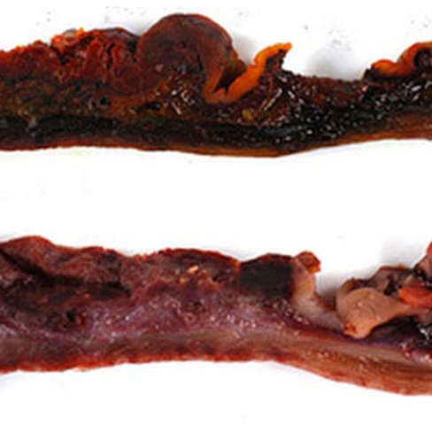 Fixateur Ddgreen sans Formol, 5 litres x 1