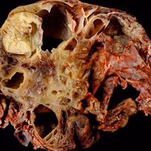 Formol 40% stabilisé, 1 litre x 1