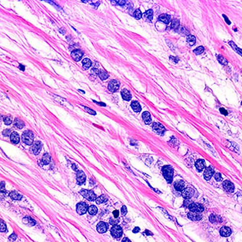 Décalcifiant rapide RDC, 1 litre x 1