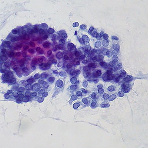 Décalcifiant moyen RDM, 1 litre x 1