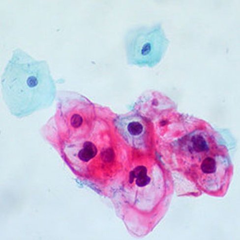 Décalcifiant modifié de Pasquini RDP, 1 litre x 1