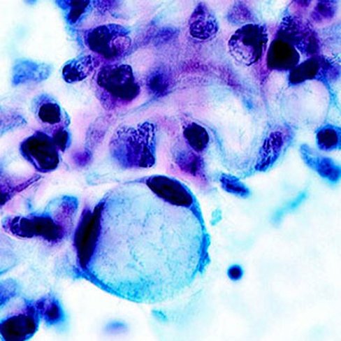 Décalcifiant avec fixateur RDL, 1 litre x 1