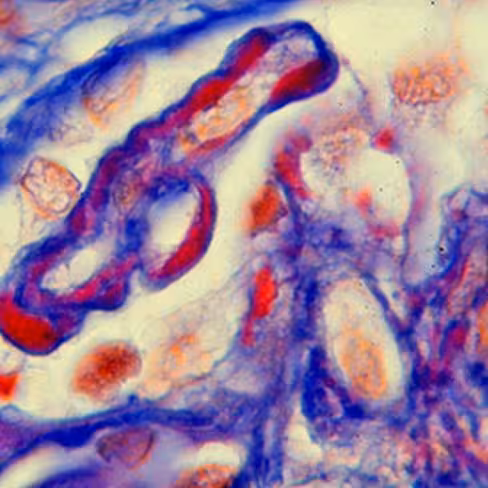 Solution de Fuchsine Acide Orange G, 500 ml x 1