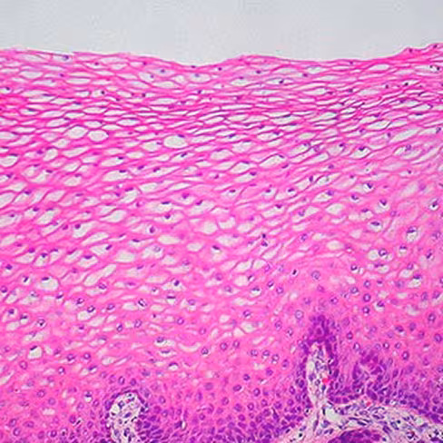 Azocarmine G, 100 ml x 1