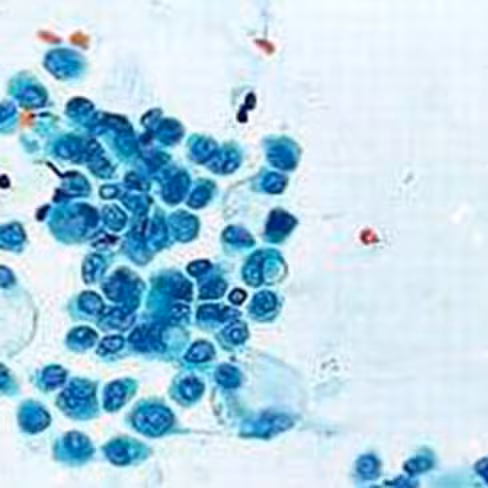 Violet de Crésyl selon Moore, 250 ml x 1