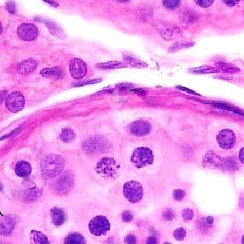 Hémalum de Carazzi, 1 litre x 1