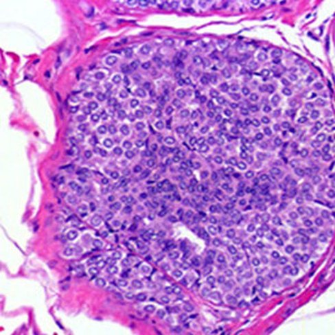 Hématoxyline chloré, 500 ml x 1