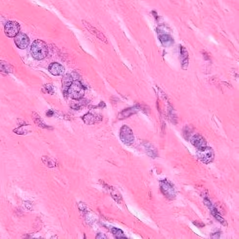 Hématoxyline Gill modifié, 1 litre x 1