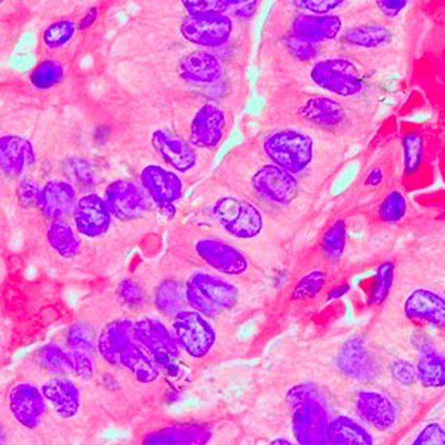 Hématoxyline de Harris stabilisé de Liscia, 1 litre x 1