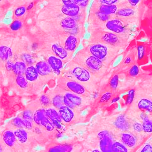 Hématoxyline de Harris modifié, 1 litre x 1