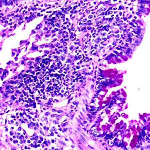Hématoxyline d'Heidenhain, 500 ml x 1