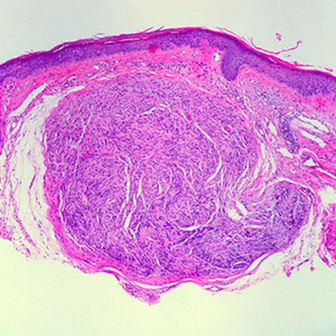 Hématoxyline phosphotungstique en solution, 500 ml x 1