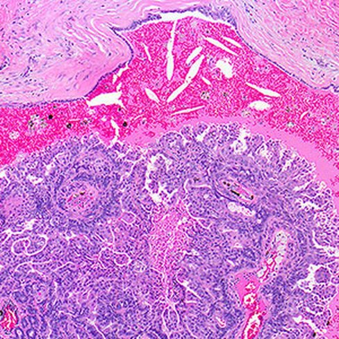 Eosine floxine alcoolique (solution stock), 500 ml x 1