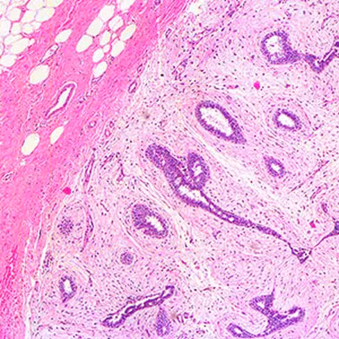 Eosine Y 1% modifié, 1 litre x 1