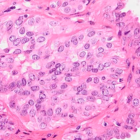 Eosine purifiée en solution, 1 litre x 1