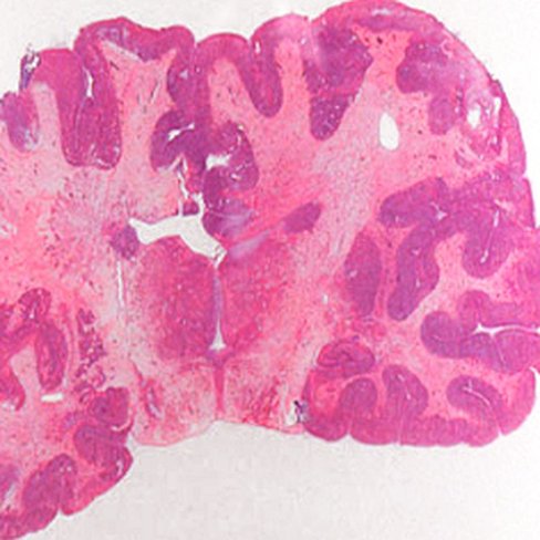 Eosine orange alcoolique (solution stock), 250 ml x 1