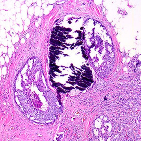 Erythrosine orange de Dominici, 250 ml x 1