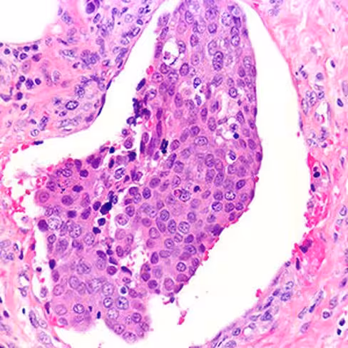 Erythrosine B, 250 ml x 1