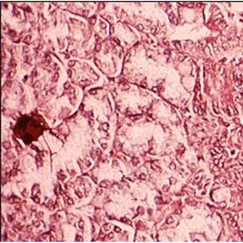 Floxine B de Gram, 250 ml x 1