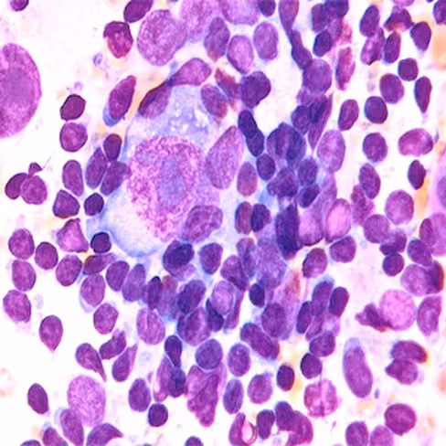 Giemsa modifiée Liscia (solution concentrée), 1 litre x 1