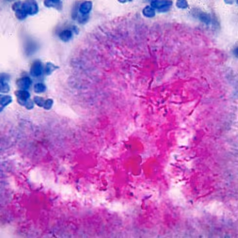 Fuchsine pour coloration Gram, 500 ml x 1