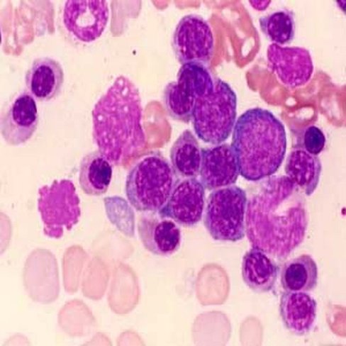 Solution de Leishmann, 100 ml x 1