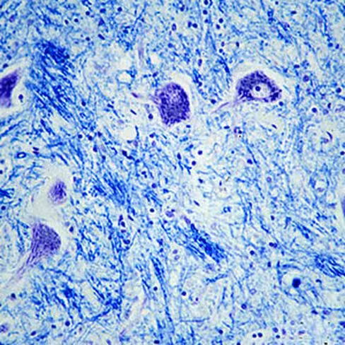 Luxol fast blue, 100 ml x 1