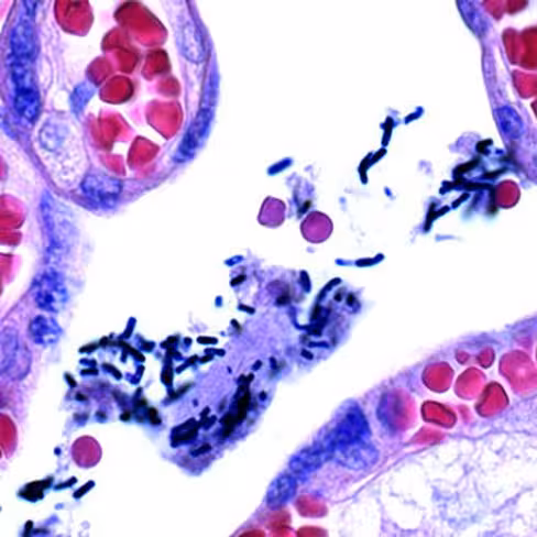 Lugol concentré, 1 litre x 1