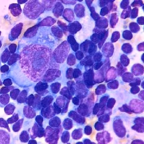 May Grünwald, 1 litre x 1