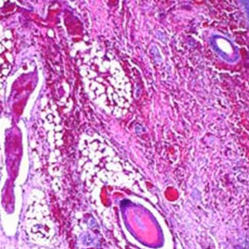 Orcéine acétique, 250 ml x 1