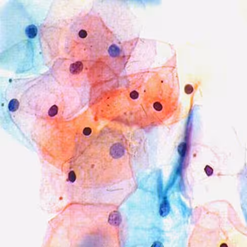 Papanicolaou EA31 polychromatique, 1 litre x 1