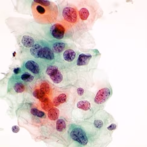 Papanicolaou EA50 polychromatique, 1 litre x 1