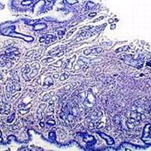 Picro indigo Carmine, 250 ml x 1